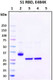 Recombinant SARS-CoV-2 S1 Subunit Protein (RBD), mutant E484K