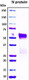 Recombinant SARS-CoV Nucleocapsid Protein