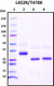 Recombinant SARS-CoV-2 S1 Subunit Protein RBD, L452R/T478K mutant