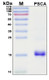 Recombinant Human Prostate Stem Cell Antigen, Antigen Grade