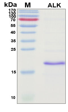SDS-PAGE