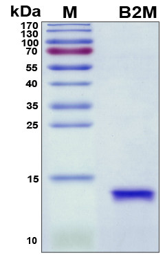 SDS-PAGE