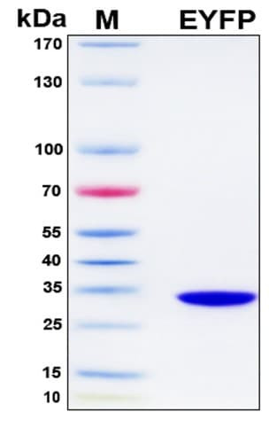 SDS-PAGE Image