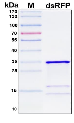 SDS-PAGE Image