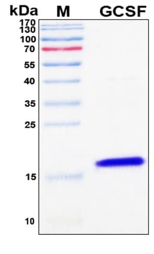 SDS-PAGE Image