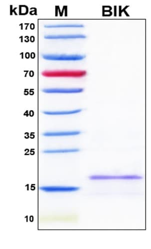 SDS-PAGE Image