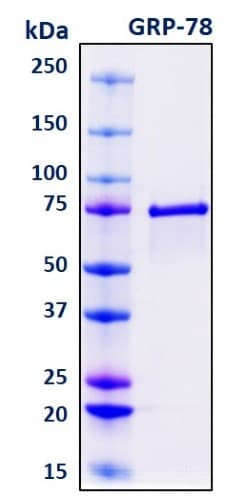 SDS-PAGE Image