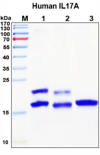 SDS-PAGE Image