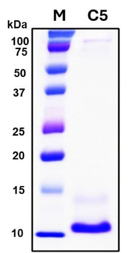 SDS-PAGE Image