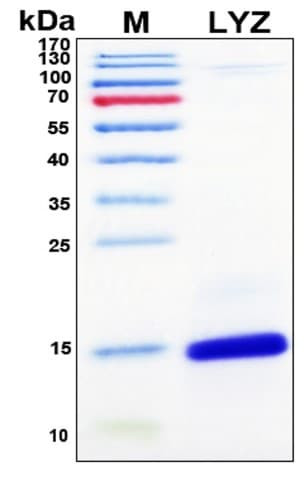 SDS-PAGE Image