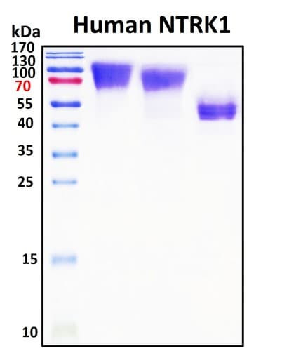 SDS-PAGE Image