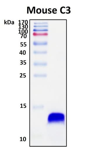 SDS-PAGE Image
