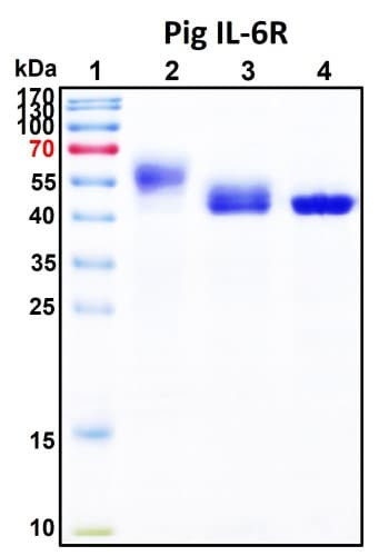 SDS-PAGE Image