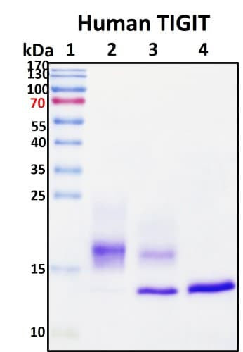 SDS-PAGE Image