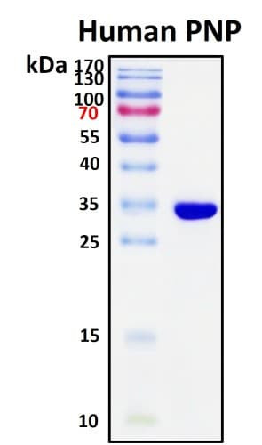 SDS-PAGE Image