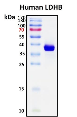 SDS-PAGE Image