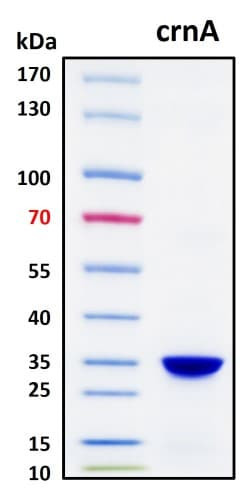 SDS-PAGE Image