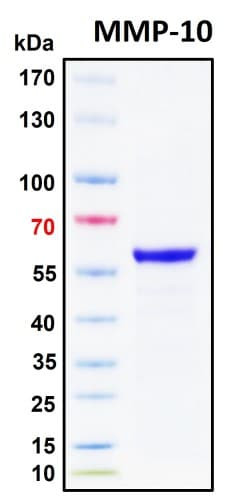 SDS-PAGE Image