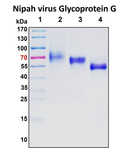 SDS-PAGE Image