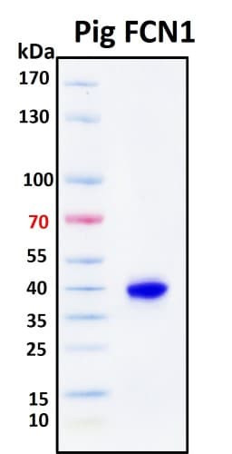 SDS-PAGE Image