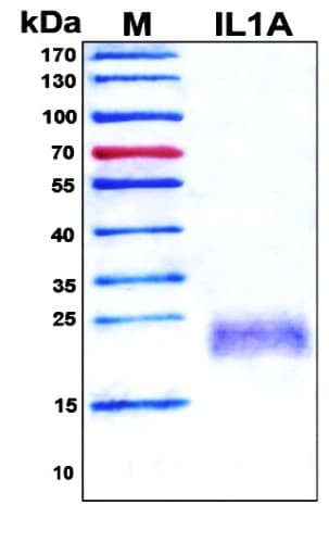 SDS-PAGE Image
