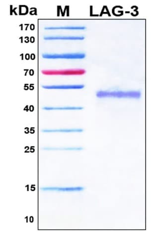 SDS-PAGE Image