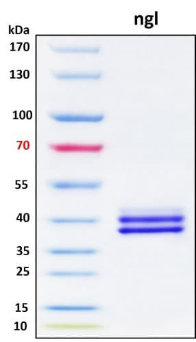 SDS-PAGE Image