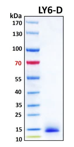 SDS-PAGE Image