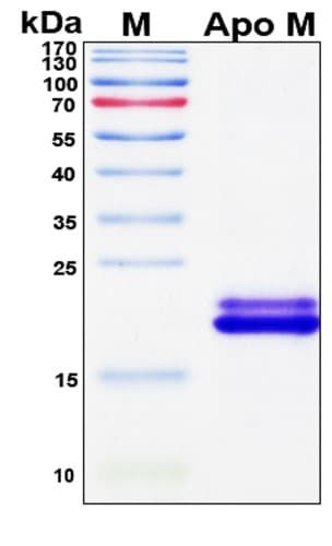 SDS-PAGE Image