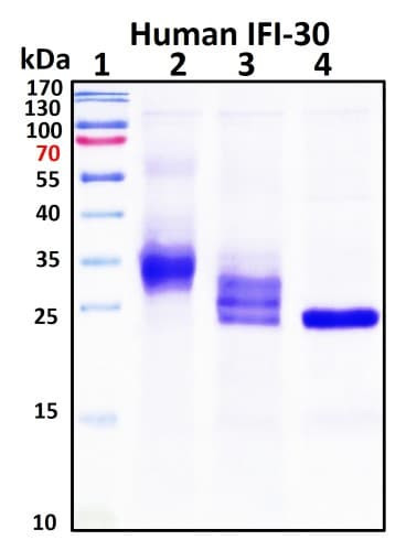 SDS-PAGE Image