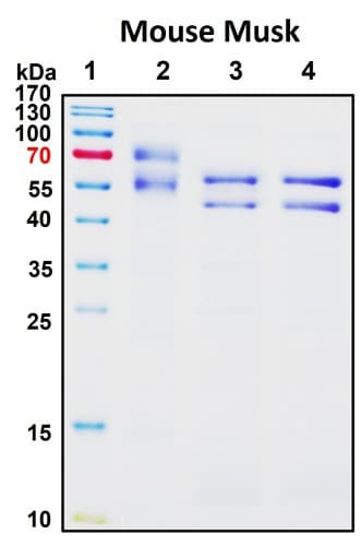 SDS-PAGE Image