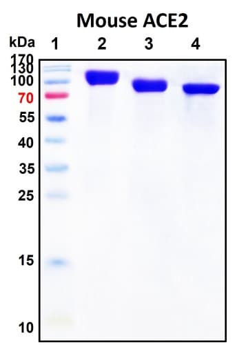 SDS-PAGE Image