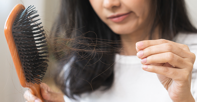 Il mio diradamento dei capelli può essere segno di una specifica carenza nutrizionale? 