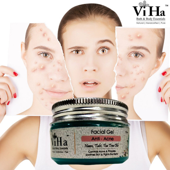 Anti - Acne Gel |By Viha Bath & Body Essentials | 1.76 Oz | 0.11 lbs | SU-TQ-MAY20