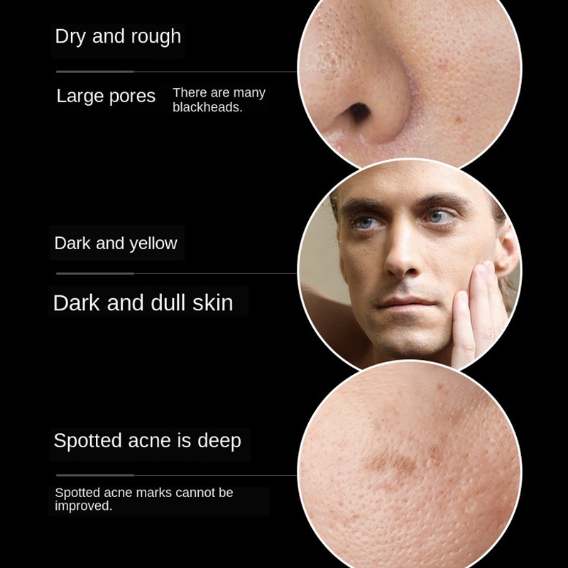 male face toner