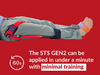 Slishman Traction Splint - Gen2