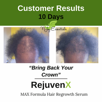 Customer's 10 days results with RejuvenX + Micro-needling Regrowth Booster