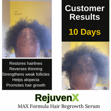 Customer's 10 days results with RejuvenX + Micro-needling Regrowth Booster
