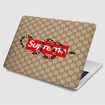 Pastele Gucci Snake Supreme MacBook Case Custom Personalized Smart Protective Cover for MacBook MacBook Pro MacBook Pro Touch MacBook Pro Retina MacBook Air Cases