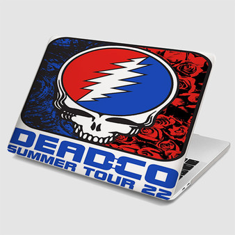 Pastele Dead and Company Summer Tour 2022 MacBook Case Custom Personalized Smart Protective Cover Awesome for MacBook MacBook Pro MacBook Pro Touch MacBook Pro Retina MacBook Air Cases Cover