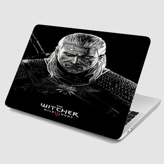 Pastele The Witcher Toxicity Poisoning MacBook Case Custom Personalized Smart Protective Cover Awesome for MacBook MacBook Pro MacBook Pro Touch MacBook Pro Retina MacBook Air Cases Cover