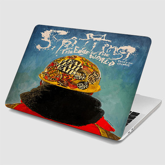 Pastele Yeah Yeah Yeahs Spitting Off the Edge of the World MacBook Case Custom Personalized Smart Protective Cover Awesome for MacBook MacBook Pro MacBook Pro Touch MacBook Pro Retina MacBook Air Cases Cover