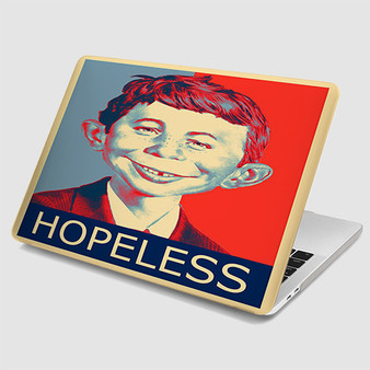 Pastele Alfred E Neuman Hopeless MacBook Case Custom Personalized Smart Protective Cover Awesome for MacBook MacBook Pro MacBook Pro Touch MacBook Pro Retina MacBook Air Cases Cover