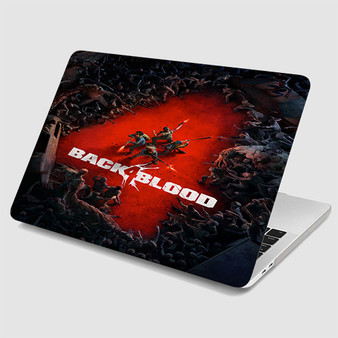 Pastele Back 4 Blood MacBook Case Custom Personalized Smart Protective Cover Awesome for MacBook MacBook Pro MacBook Pro Touch MacBook Pro Retina MacBook Air Cases Cover
