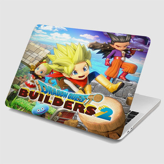 Pastele Dragon Quest Builders 2 MacBook Case Custom Personalized Smart Protective Cover Awesome for MacBook MacBook Pro MacBook Pro Touch MacBook Pro Retina MacBook Air Cases Cover