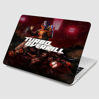 Pastele Turbo Overkill MacBook Case Custom Personalized Smart Protective Cover Awesome for MacBook MacBook Pro MacBook Pro Touch MacBook Pro Retina MacBook Air Cases Cover