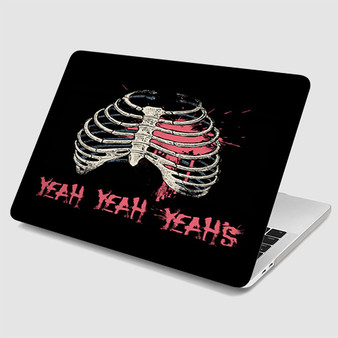 Pastele Yeah Yeah Yeahs MacBook Case Custom Personalized Smart Protective Cover Awesome for MacBook MacBook Pro MacBook Pro Touch MacBook Pro Retina MacBook Air Cases Cover