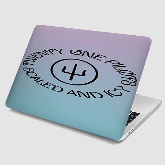 Pastele Twennty One Pilots Scaled and Icy MacBook Case Custom Personalized Smart Protective Cover Awesome for MacBook MacBook Pro MacBook Pro Touch MacBook Pro Retina MacBook Air Cases Cover