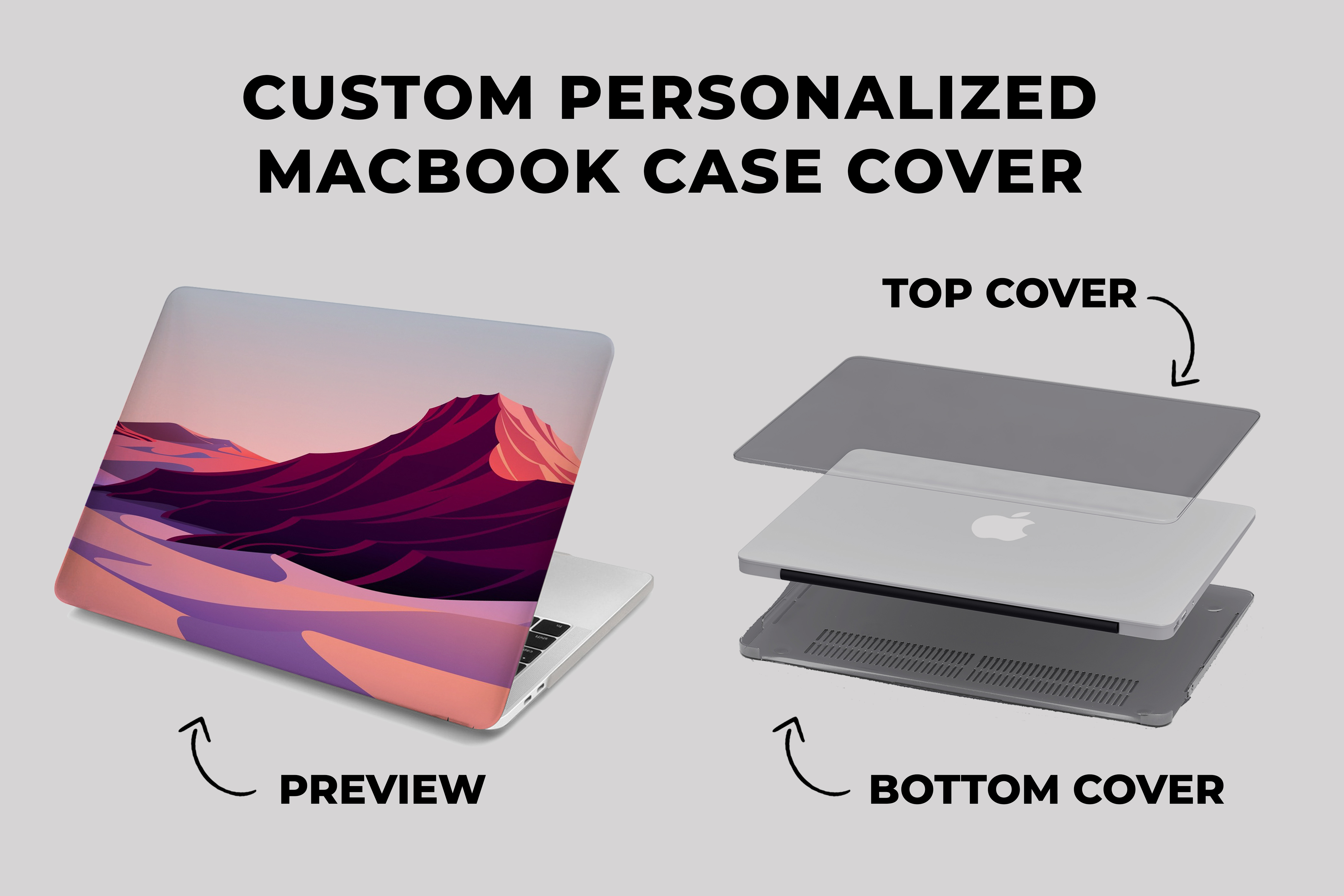 Pastele Gucci Supreme Louis Vuitton MacBook Case Custom