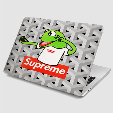 Pastele Kermit Supreme MacBook Case Custom Personalized Smart Protective  Cover for MacBook MacBook Pro MacBook Pro